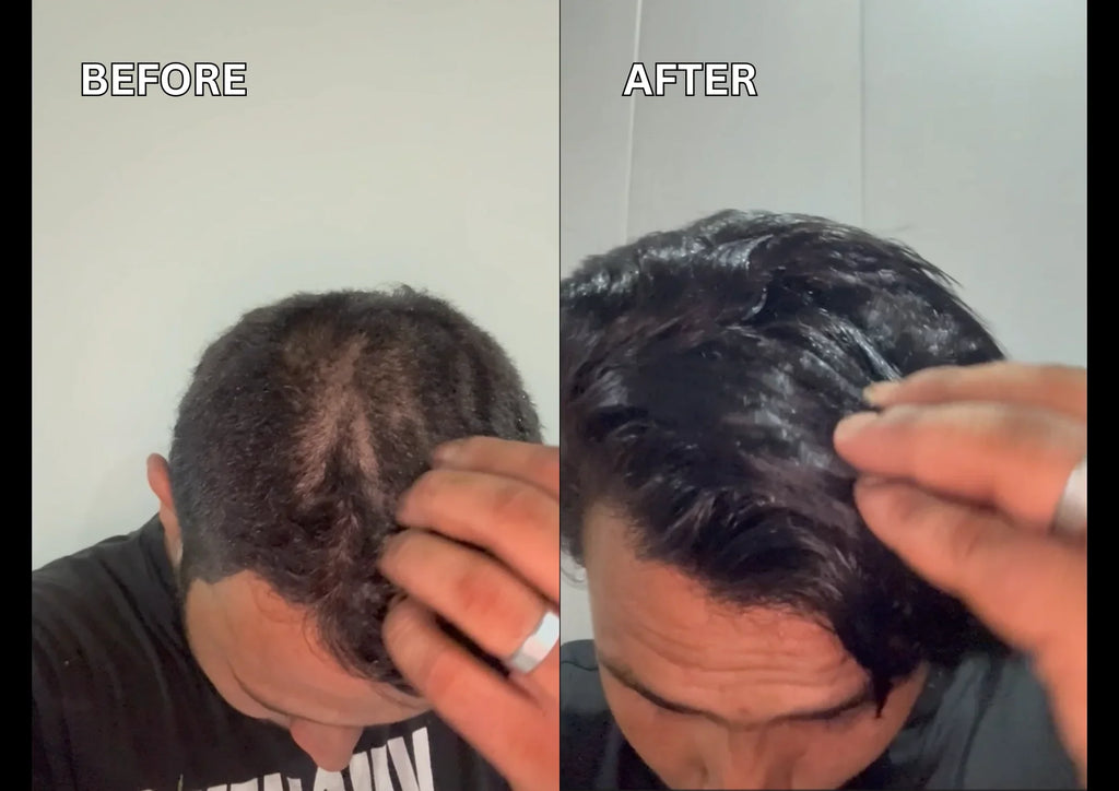 Best Hair Oil in Pakistan – Regrowth Hair Oil