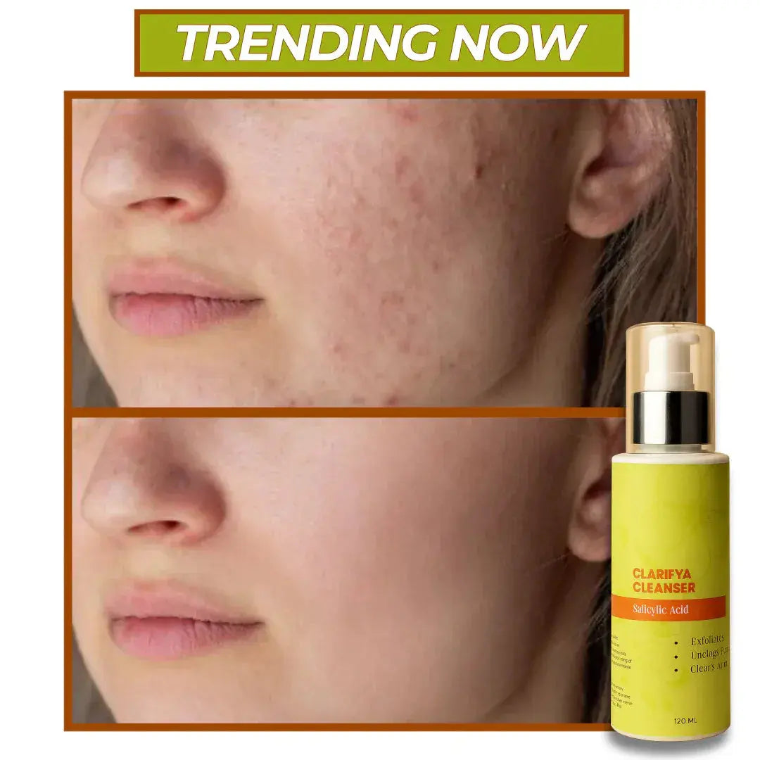 Clarifya Cleanser | Exfoliating & Clears Active Acne Gel | Salicylic Acid | 120ml